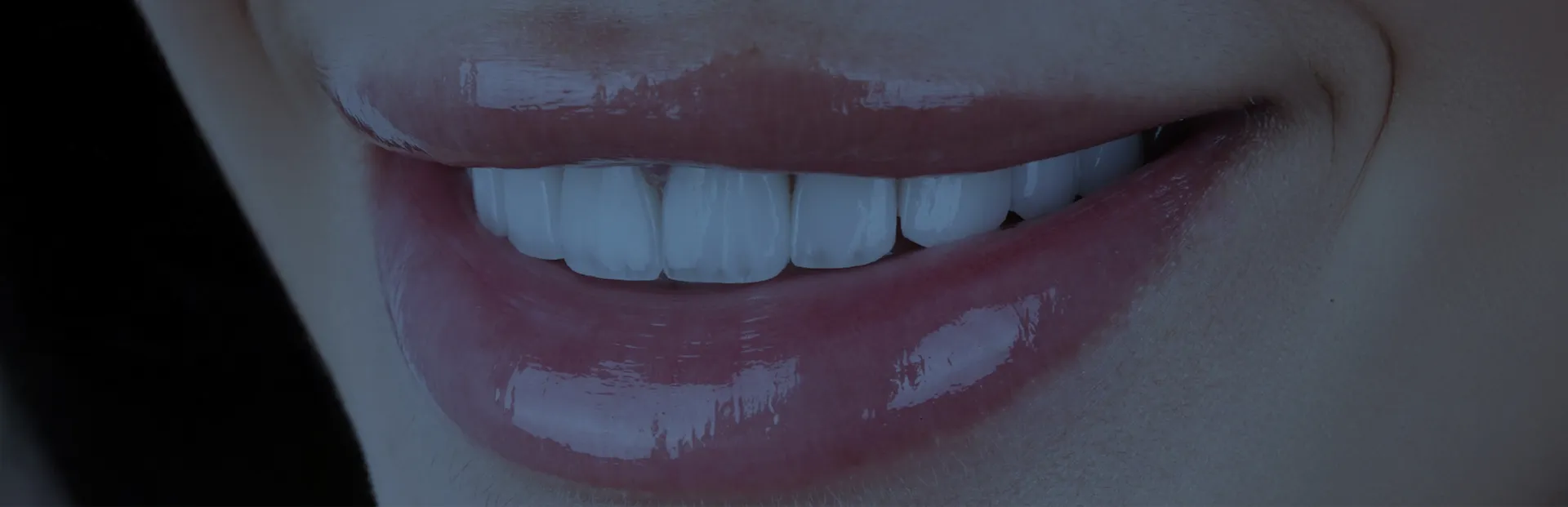 HOLLYWOOD GÜLÜŞ TASARIMI