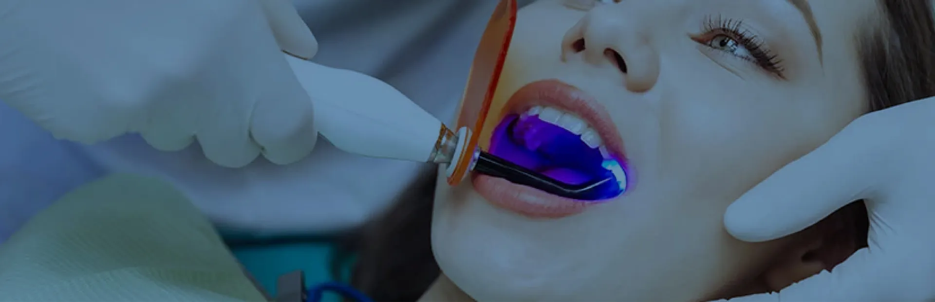 İÇ DİŞ BEYAZLATMA