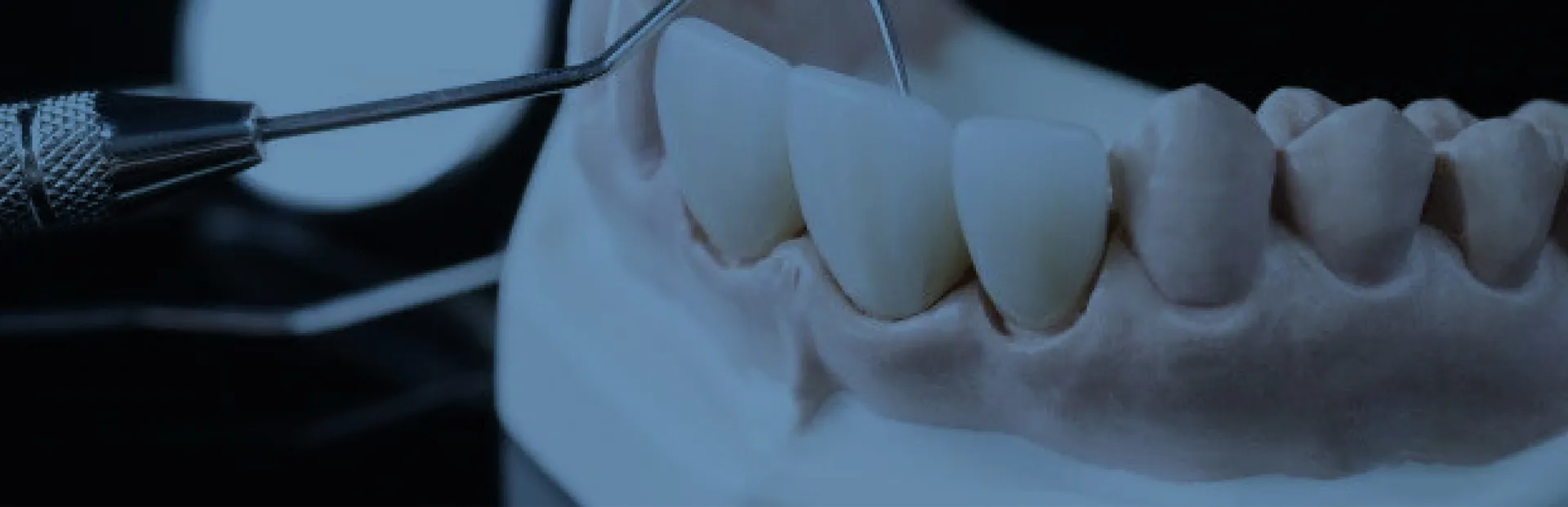 ZİRKONYA KURON VE KÖPRÜLER