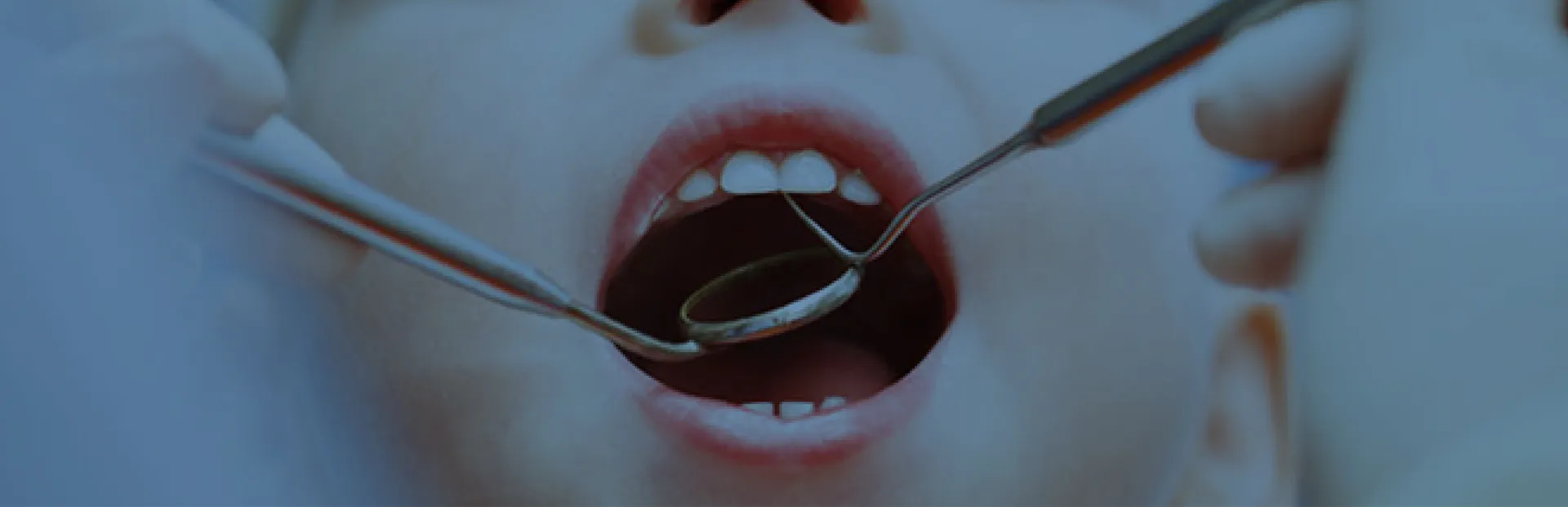 Tek Seanslık Kök Kanal Tedavisi